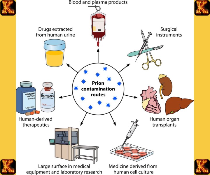 Clinical Diagnosis of Prions as Nontraditional Infectious Agents