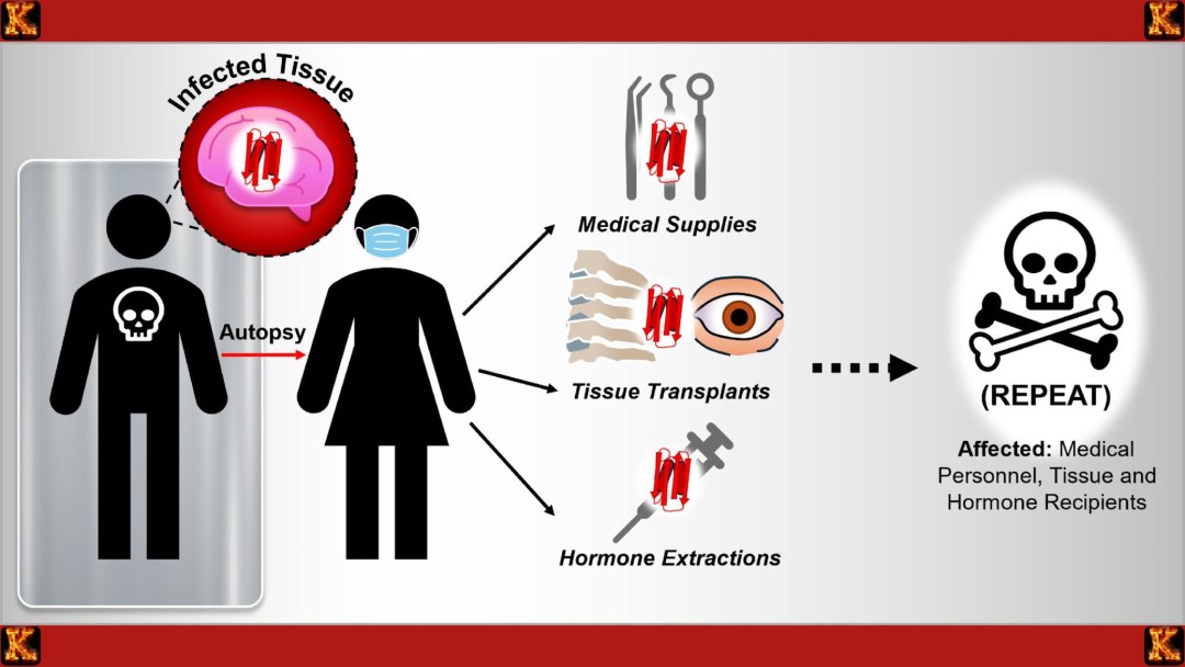 Clinical Diagnosis of Prions as Nontraditional Infectious Agents